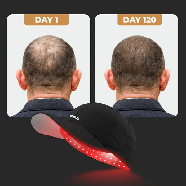 Gorro Luz Roja Capilar | Tratamiento Anticaída en Casa | RAIZLUX™